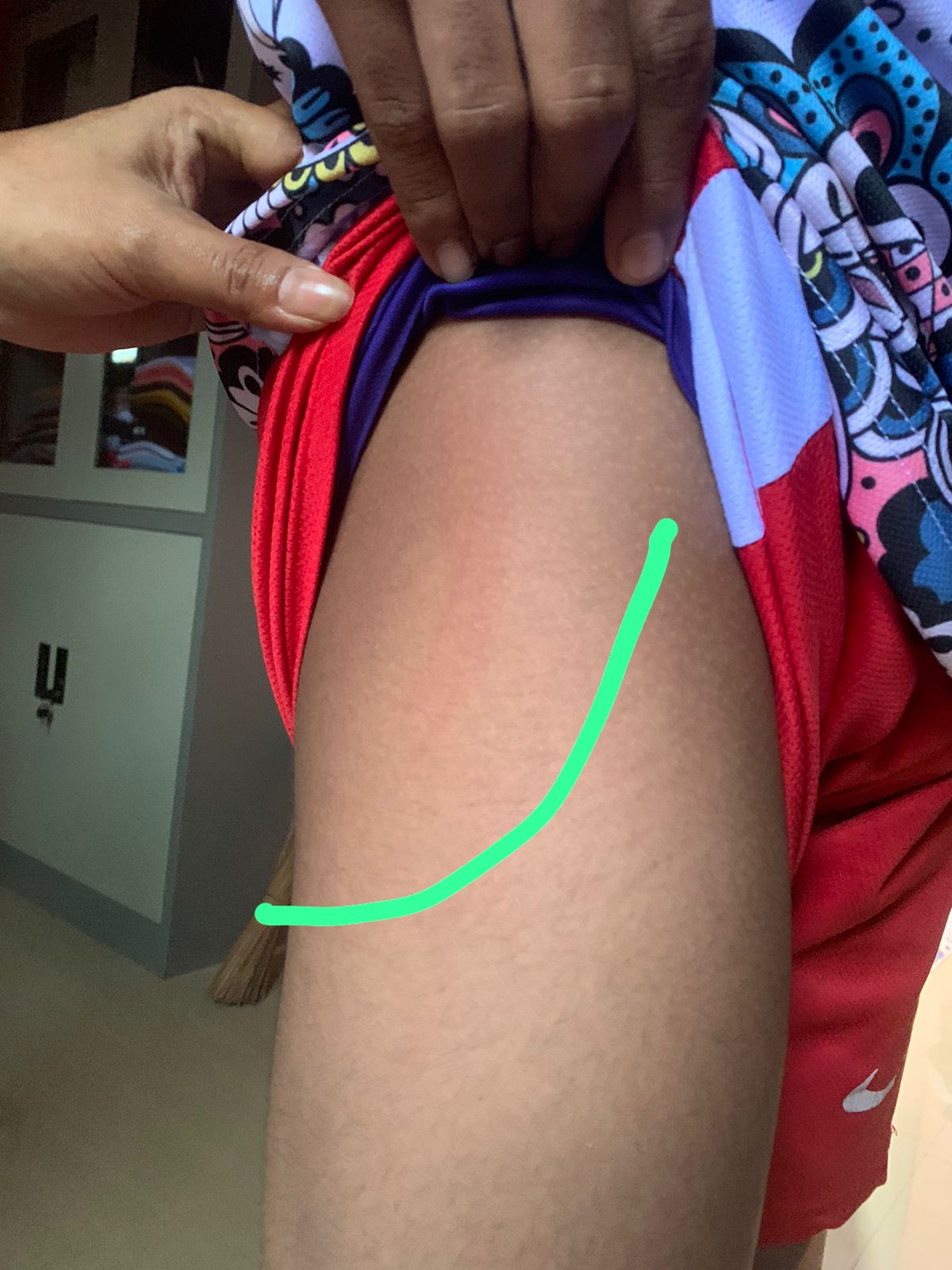 Astaga! Oknum Guru Salah Satu SMK di Bolmut Diduga Aniaya Muridnya