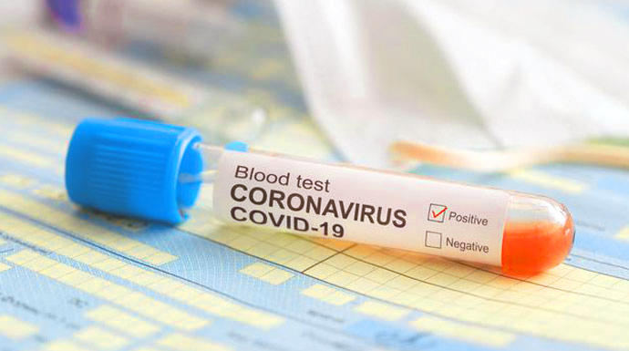 Kasus Sembuh Covid-19 Pecahkan Rekor