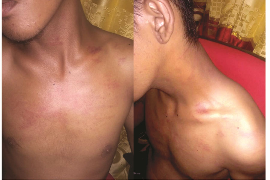 Oknum Polisi Polresta Manado Diduga Lakukan Penganiayaan 